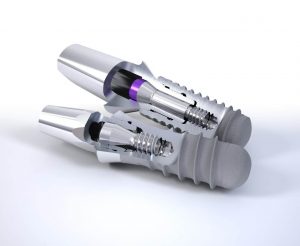 broken teeth treatment dentist charlotte
