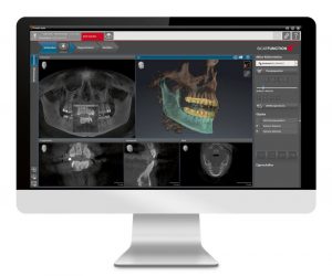 digital cosmetic dentistry examination in charlotte, nc