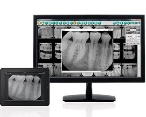 digital dentistry technology at Charlotte Center For Cosmetic Dentistry